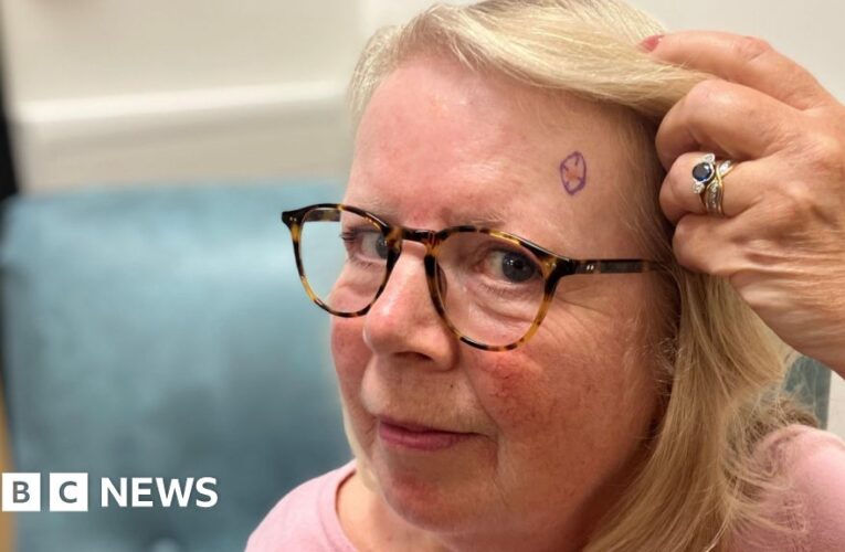 Digital imaging cuts waiting times for skin cancer
